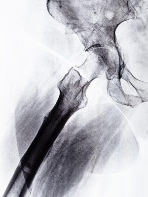 X-ray | Dr. Robert Ference